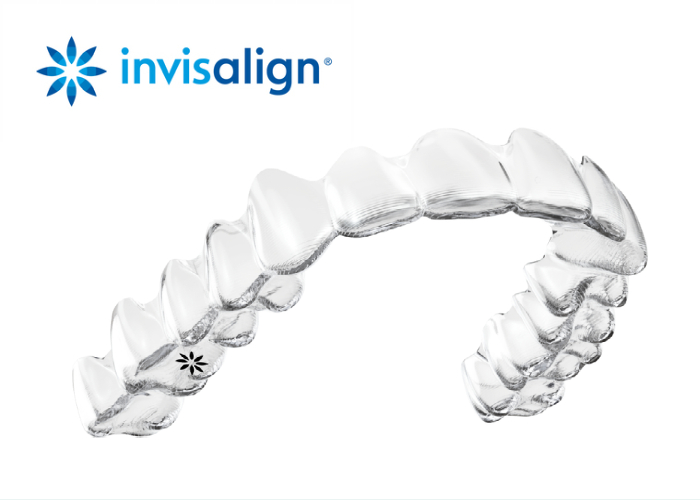 invisalign (1)